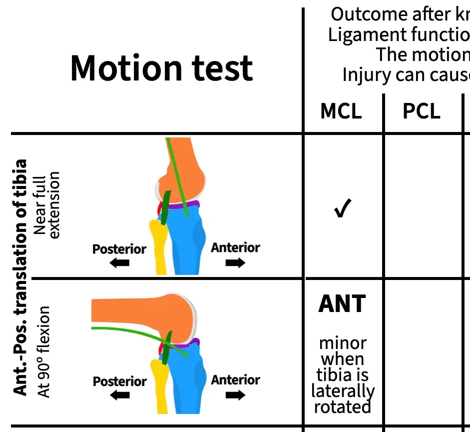 Portion of the worksheet with answers filled in for the knock-out test of the MCL and anterior-posterior translation