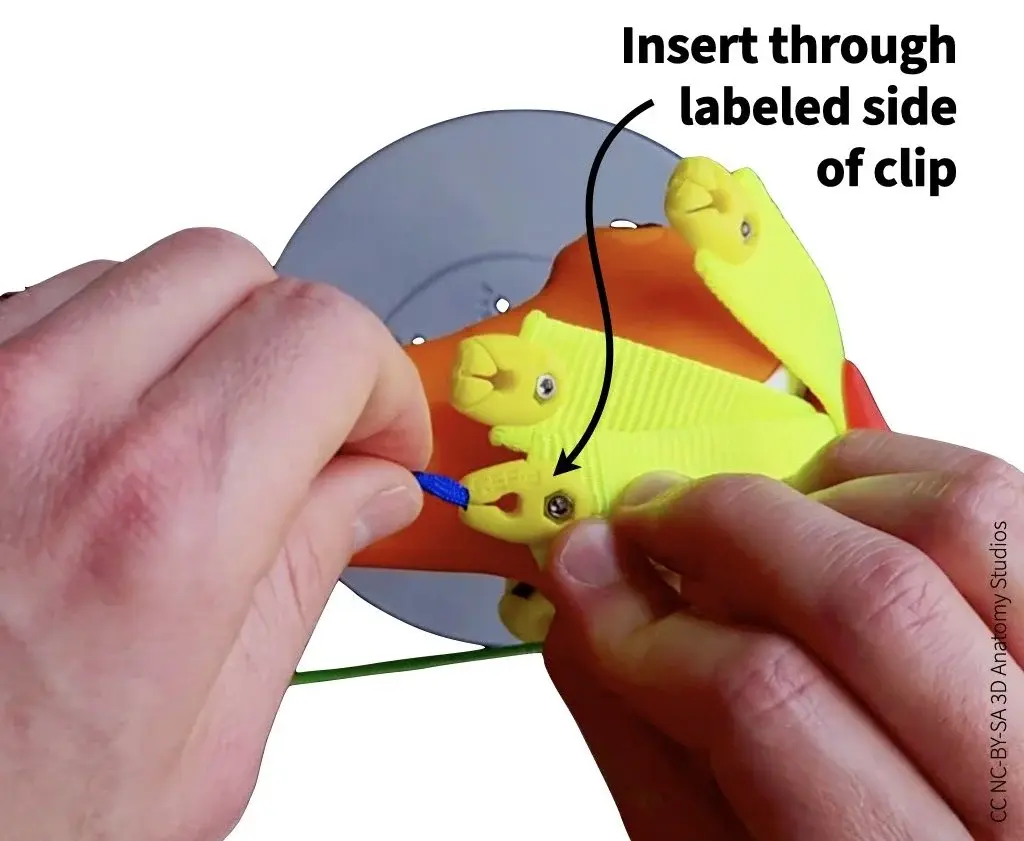 Photo of hands inserting a manual muscle cord into a quadriceps tendon clip showing how the cord must be inserted through the labeled side of the clip first