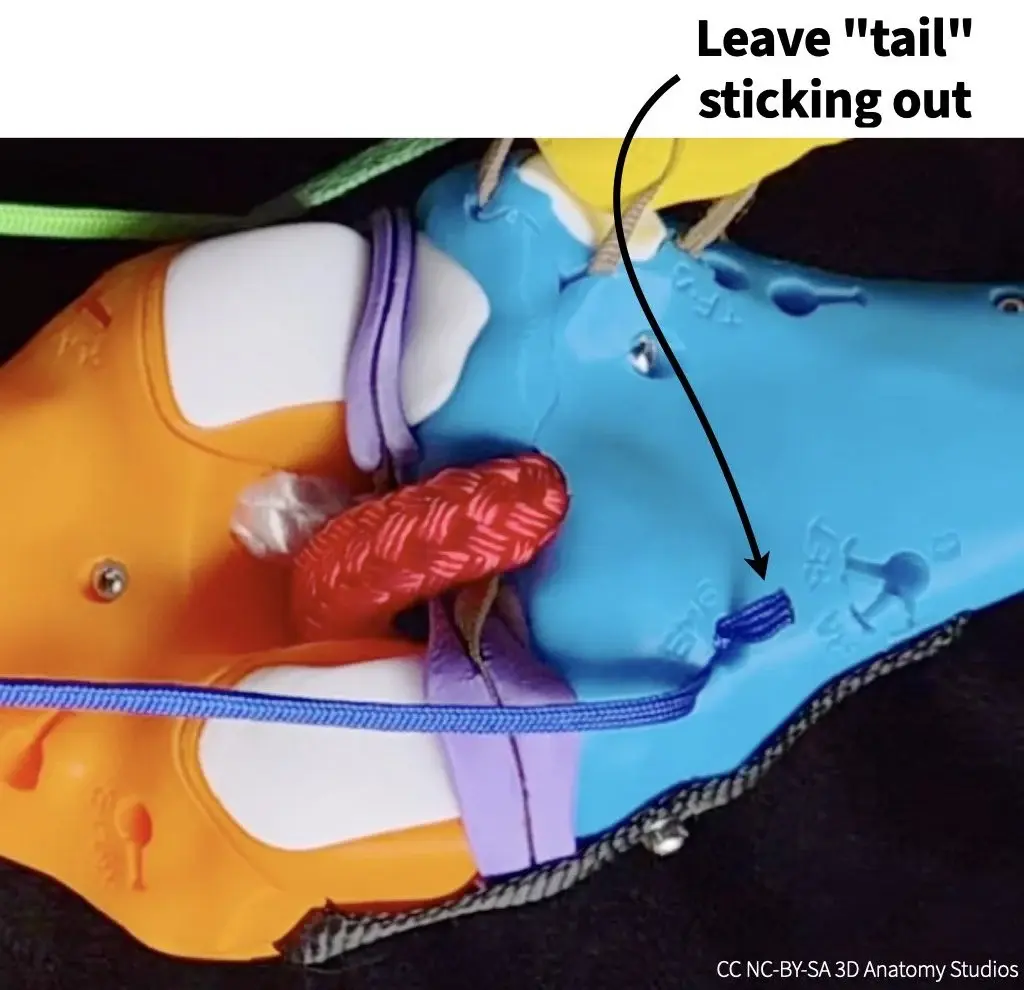Photo of a manual muscle cord inserted into an attachment hole with the tail of the cord sticking out