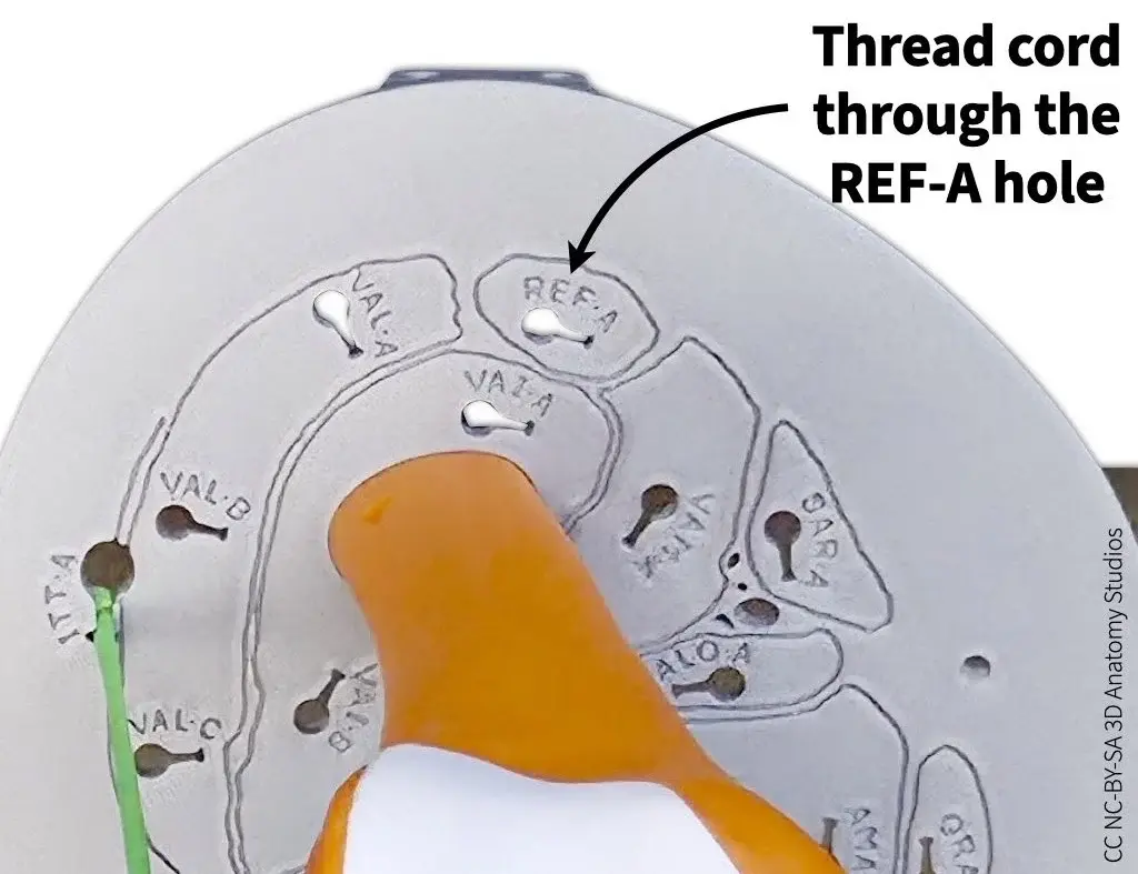 Photo of the superior cross-section plate from an inferior view indicating the attachment hole for the rectus femoris
