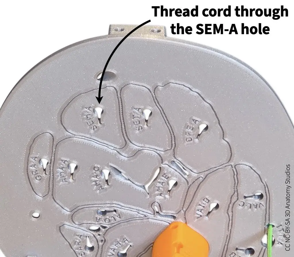 Photo of the superior cross-section plate from an inferior view indicating the attachment hole for the semimembranosus