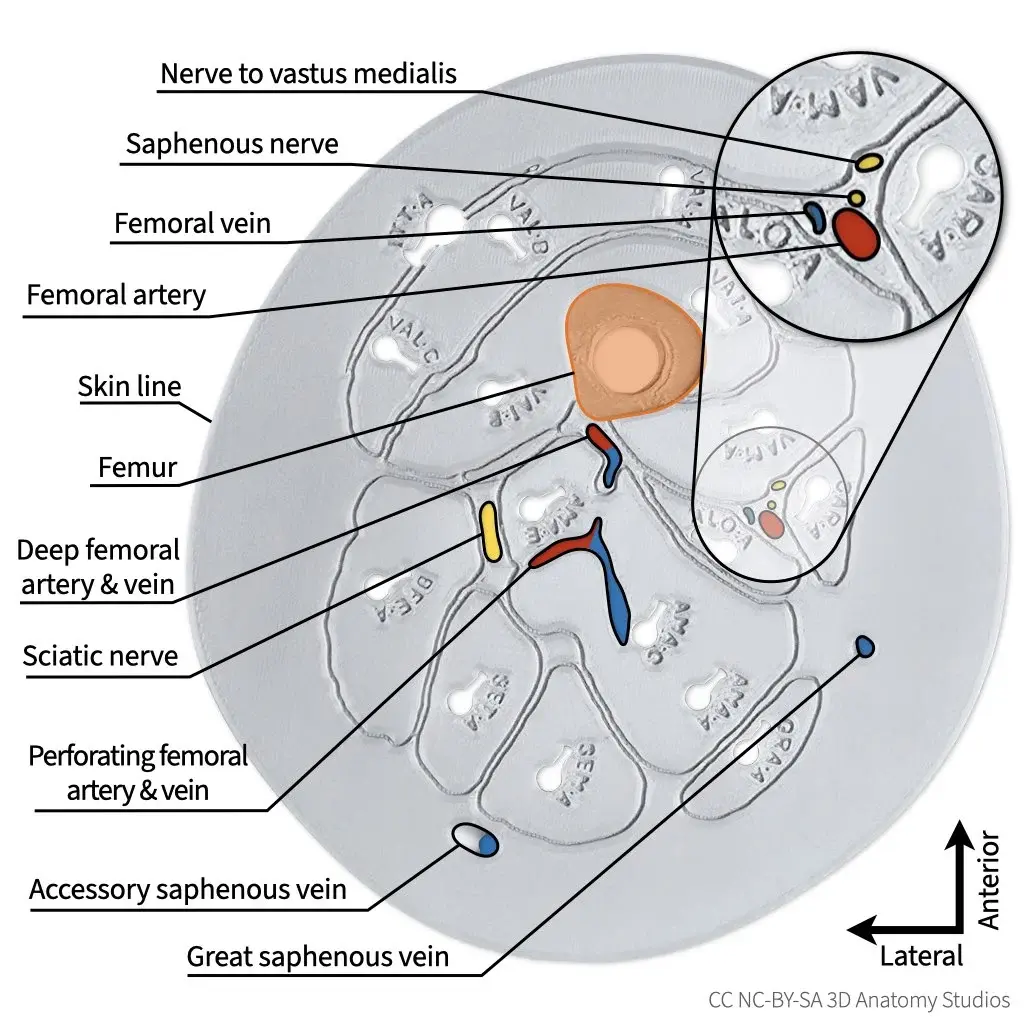 A photo of the superior cross-section plate with lines and labels for all arteries, veins, and nerves